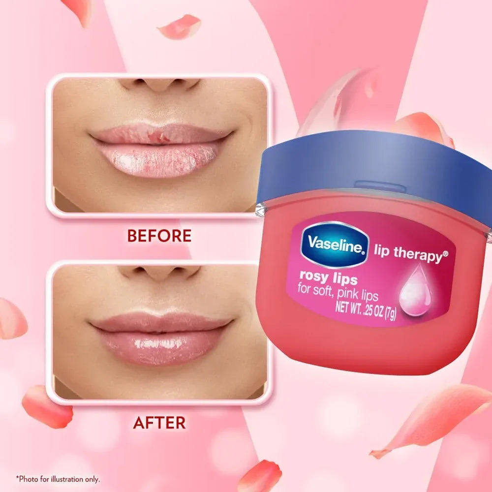 Vaseline Lip Therapy Lip Balm Rosy Lips - 7g
