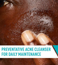 CeraVe Acne Control Cleanser Salicylic Acid 2% Oil Absorbing Technology - 237ml